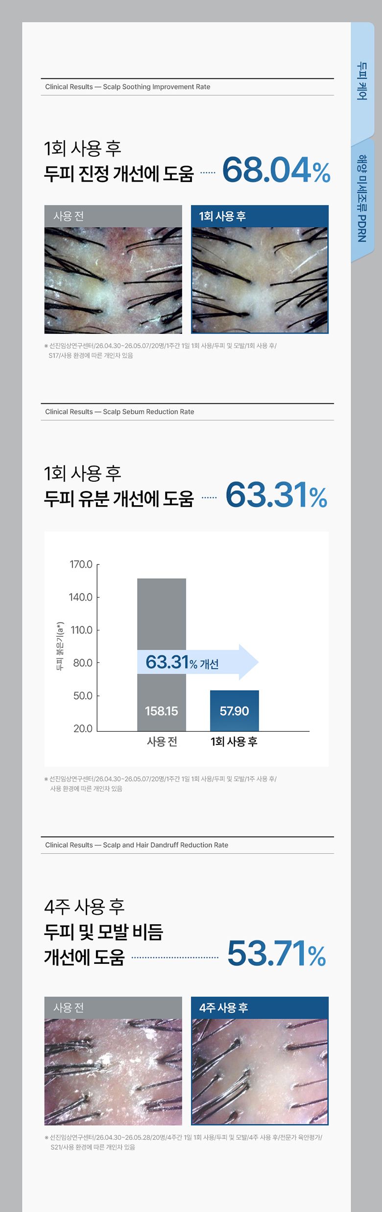 ★최쇼단독/홈쇼핑유일판매처★[최신상카이스트탈모볼륨샴푸시즌2]그래비티 PDRN 헤어 리커버리 샴푸 6개 탈모샴푸 대용량샴푸